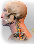 A Virtual Neck Brace For Volatility